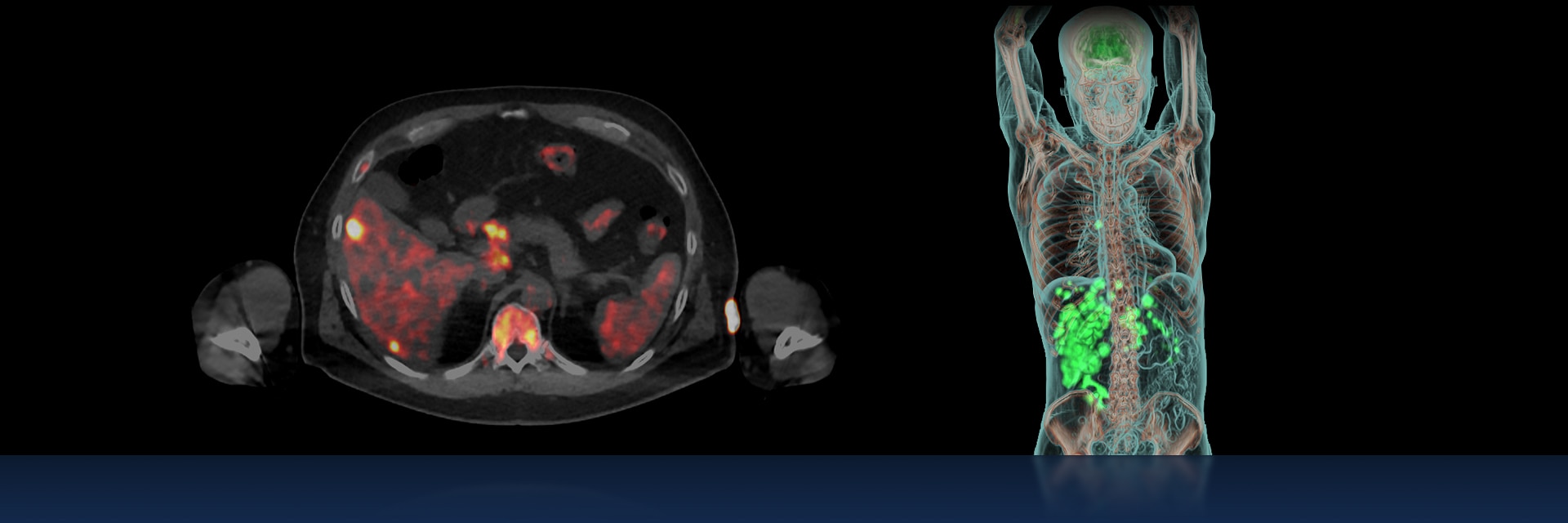 GEHC MI Landing Page Updates PET-CT Image 1